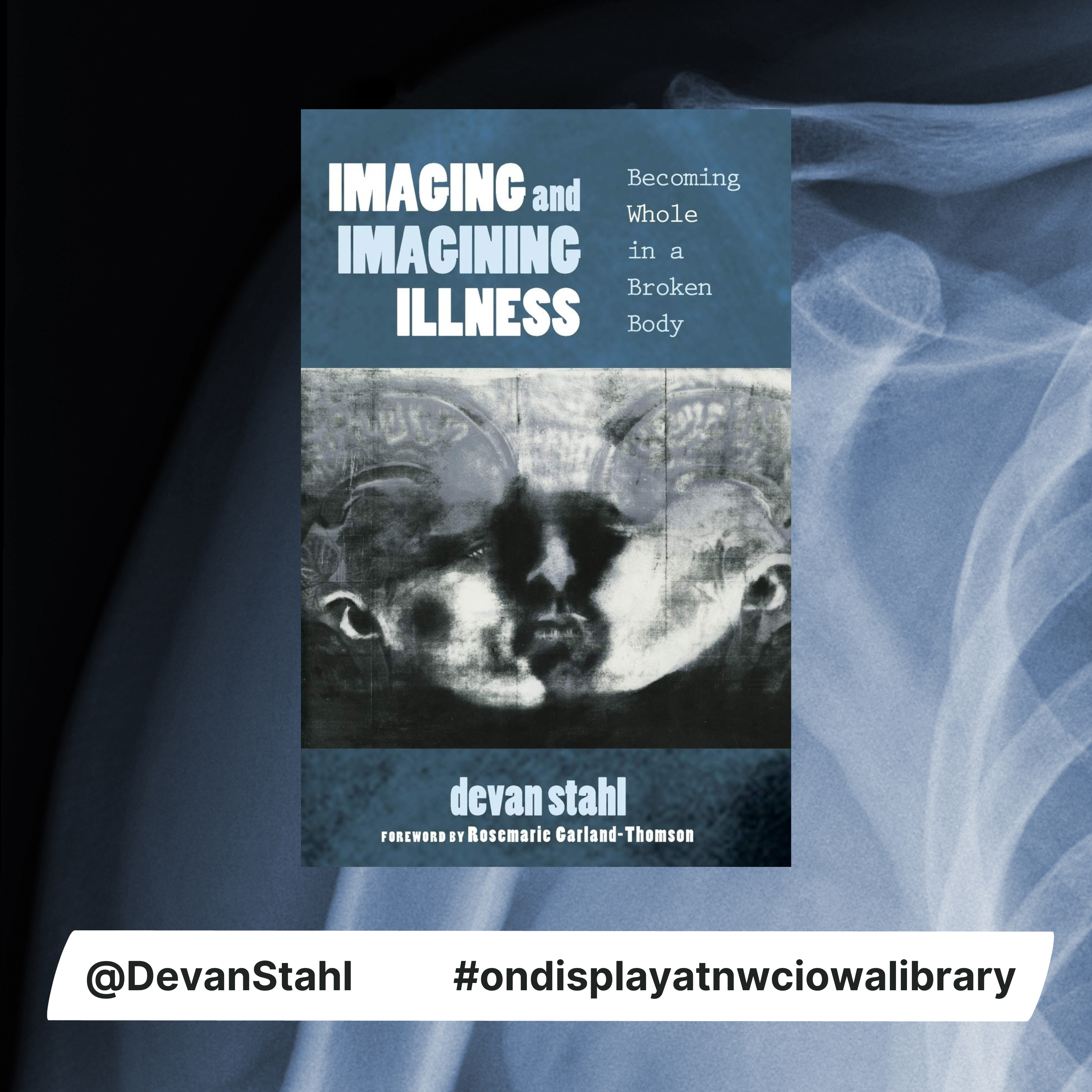 Imaging and Imagining Illness: Becoming Whole in a Broken Body by Dr. Devan Stahl